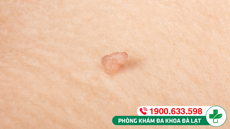 Hình ảnh minh họa